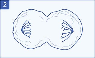 An illustration of a mesothelioma cell splitting in two.