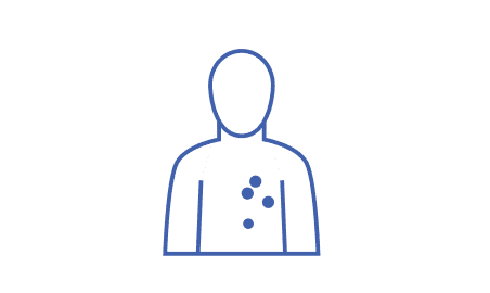 Figure with skin irritation on their chest.