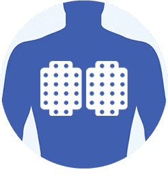 An illustration of an upper torso with the Optune Lua arrays placed on the chest.